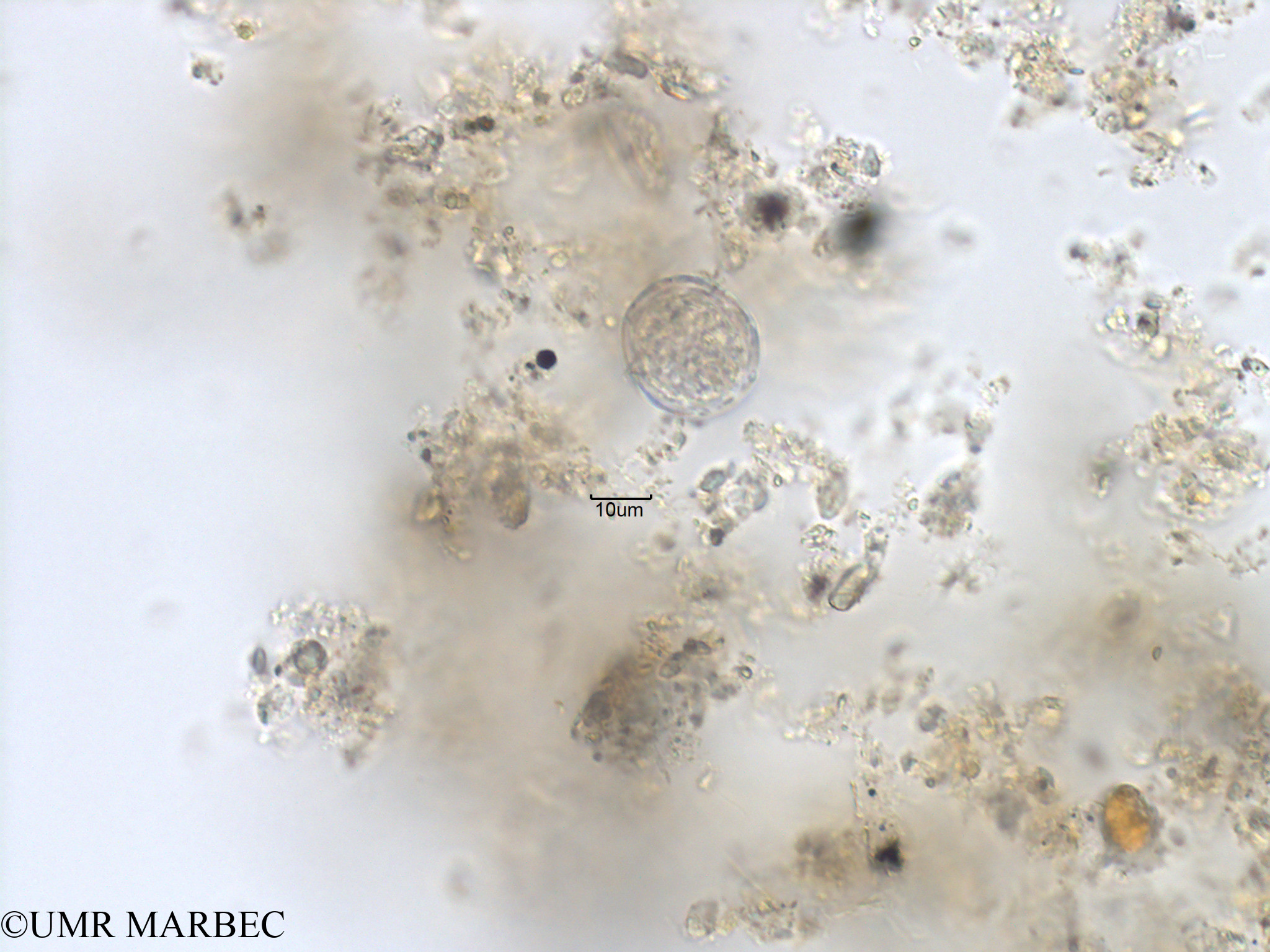 phyto/Bizerte/bizerte_bay/RISCO November 2015/Palaeophalacroma sp (Protoceratium sp3 -Baie_T1B-cf Protoceratium-6)(copy).jpg